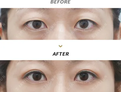 Before & After