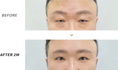 Before & After