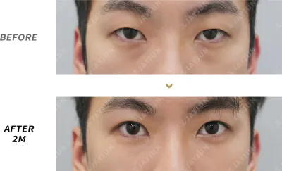 Before & After