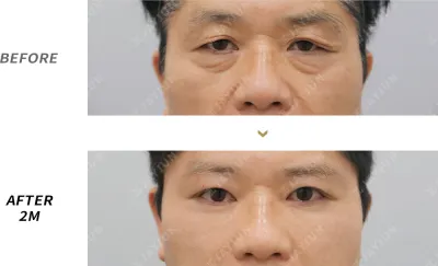 Before & After
