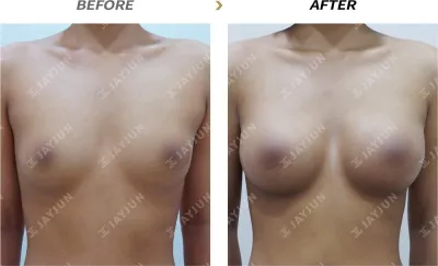 Before & After
