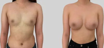 Before & After