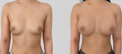 Before & After