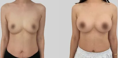 Before & After