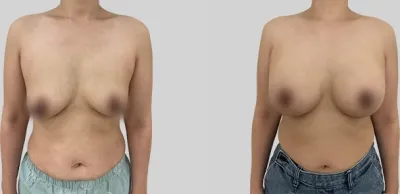 Before & After