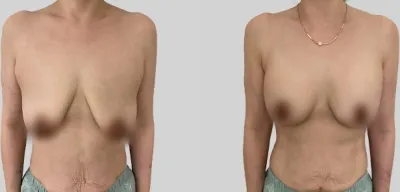 Before & After