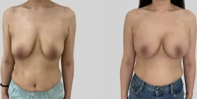 Before & After