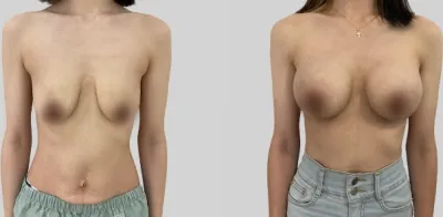 Before & After