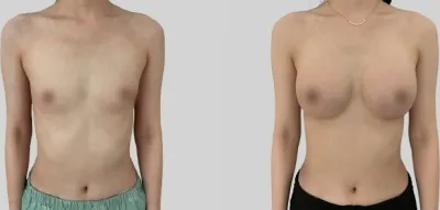 Before & After