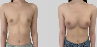 Before & After