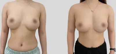 Before & After