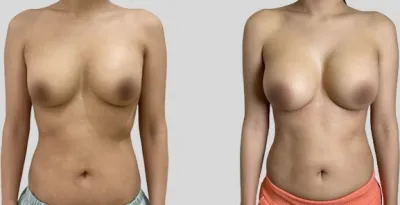 Before & After