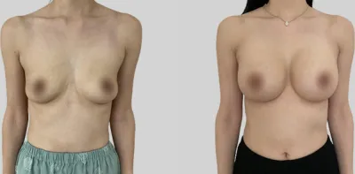 Before & After
