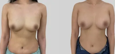 Before & After