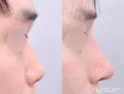 Before & After
