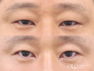 Before & After
