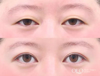 Before & After