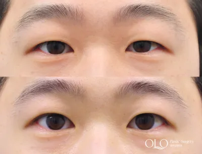 Before & After