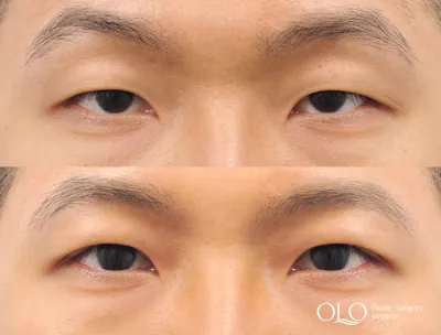 Before & After