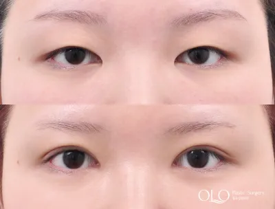 Before & After