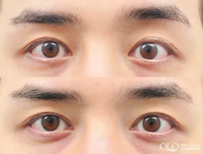 Before & After