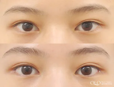 Before & After