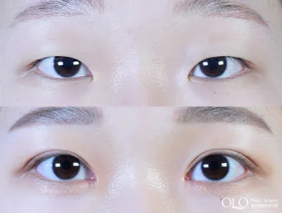 Before & After