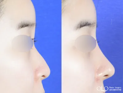 Before & After