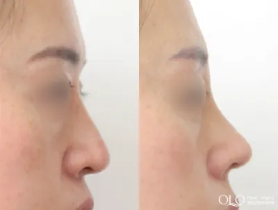 Before & After