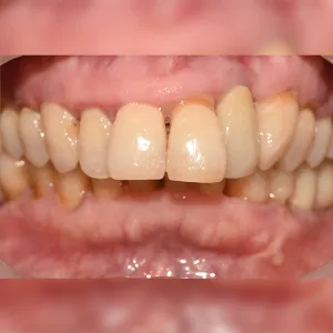 After