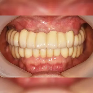 After