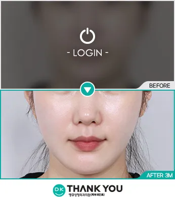 Before & After