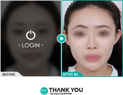 Before & After