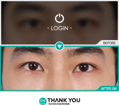Before & After