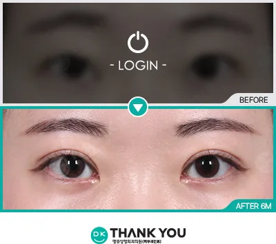 Before & After