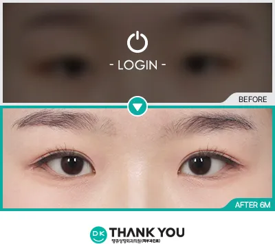 Before & After
