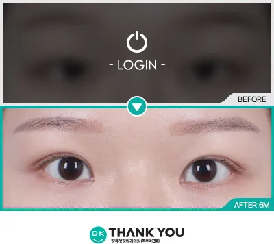 Before & After