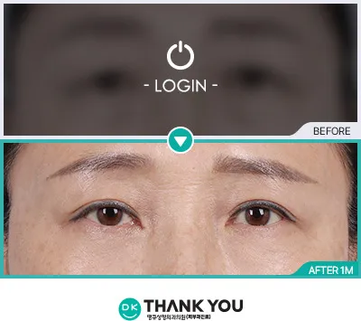 Before & After