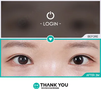 Before & After