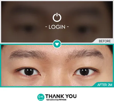 Before & After