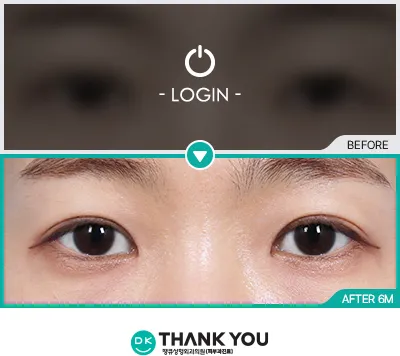 Before & After