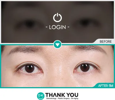 Before & After