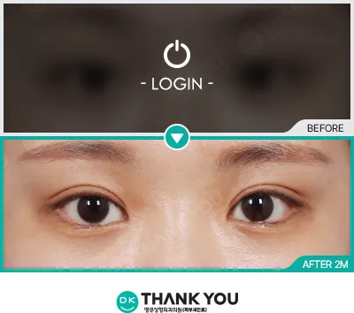 Before & After