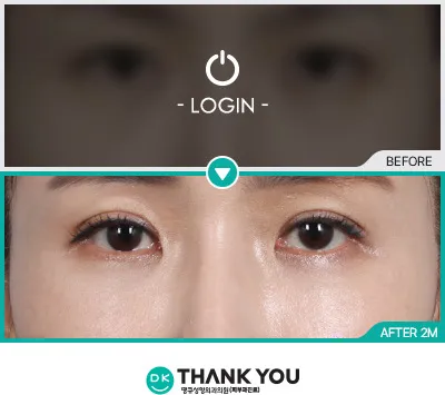 Before & After