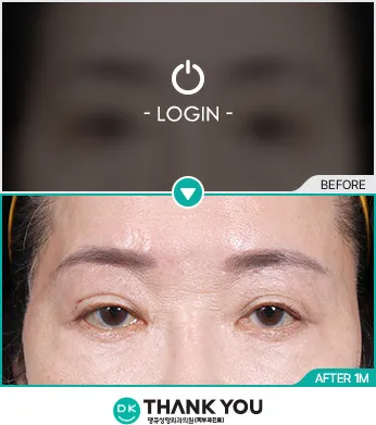 Before & After