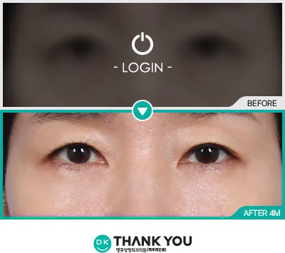 Before & After