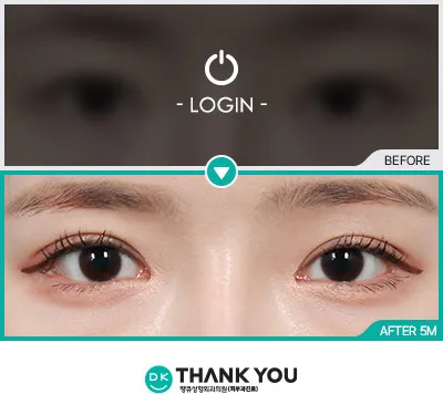 Before & After