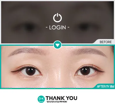 Before & After