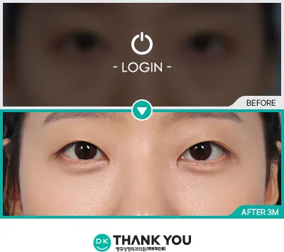 Before & After