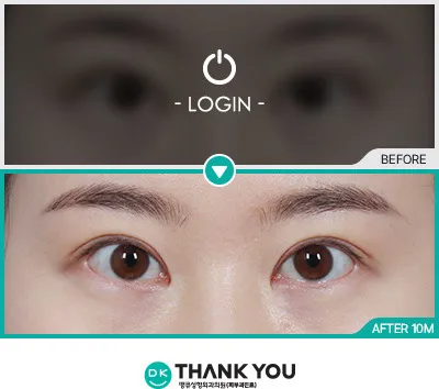 Before & After
